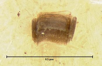 Media type: image;   Entomology 6575 Aspect: body parts
